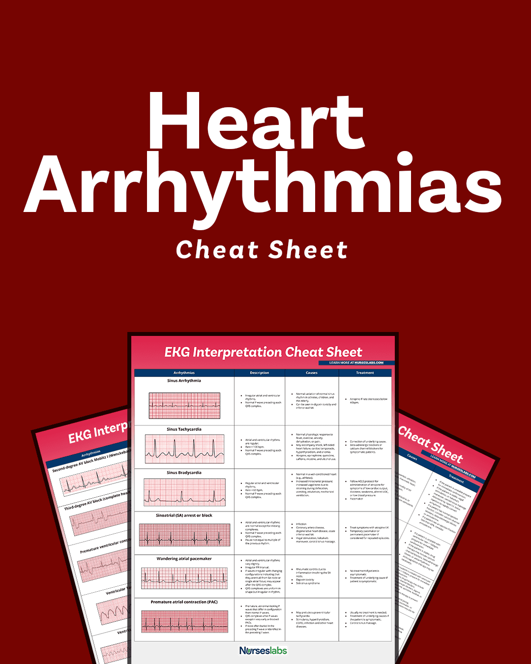 EKG Interpretation Cheat Sheet Heart Arrhythmias Guide 2020 Update 