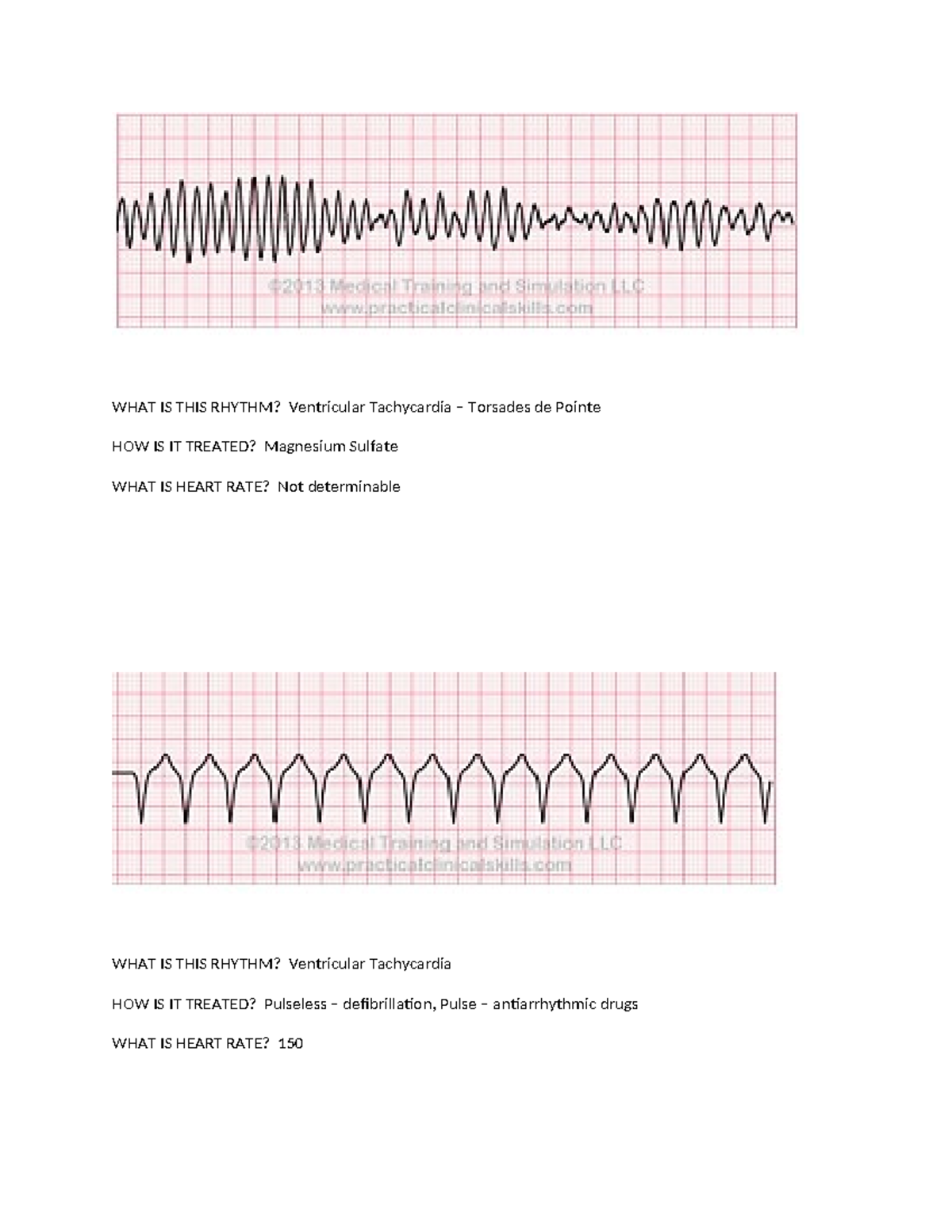 ekg practice worksheets with answers