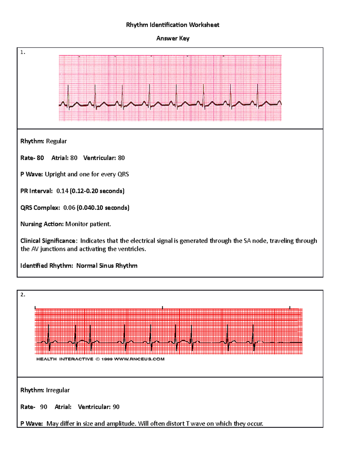 EKG Rhythm Identification Worksheet Answer Key For Clinical Practice Studocu