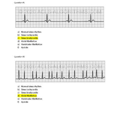 EKG Rhythm Strips Practice 1 Answer Key And Explanations Studocu
