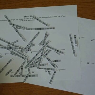 Karyotyping Lab Project YouTube
