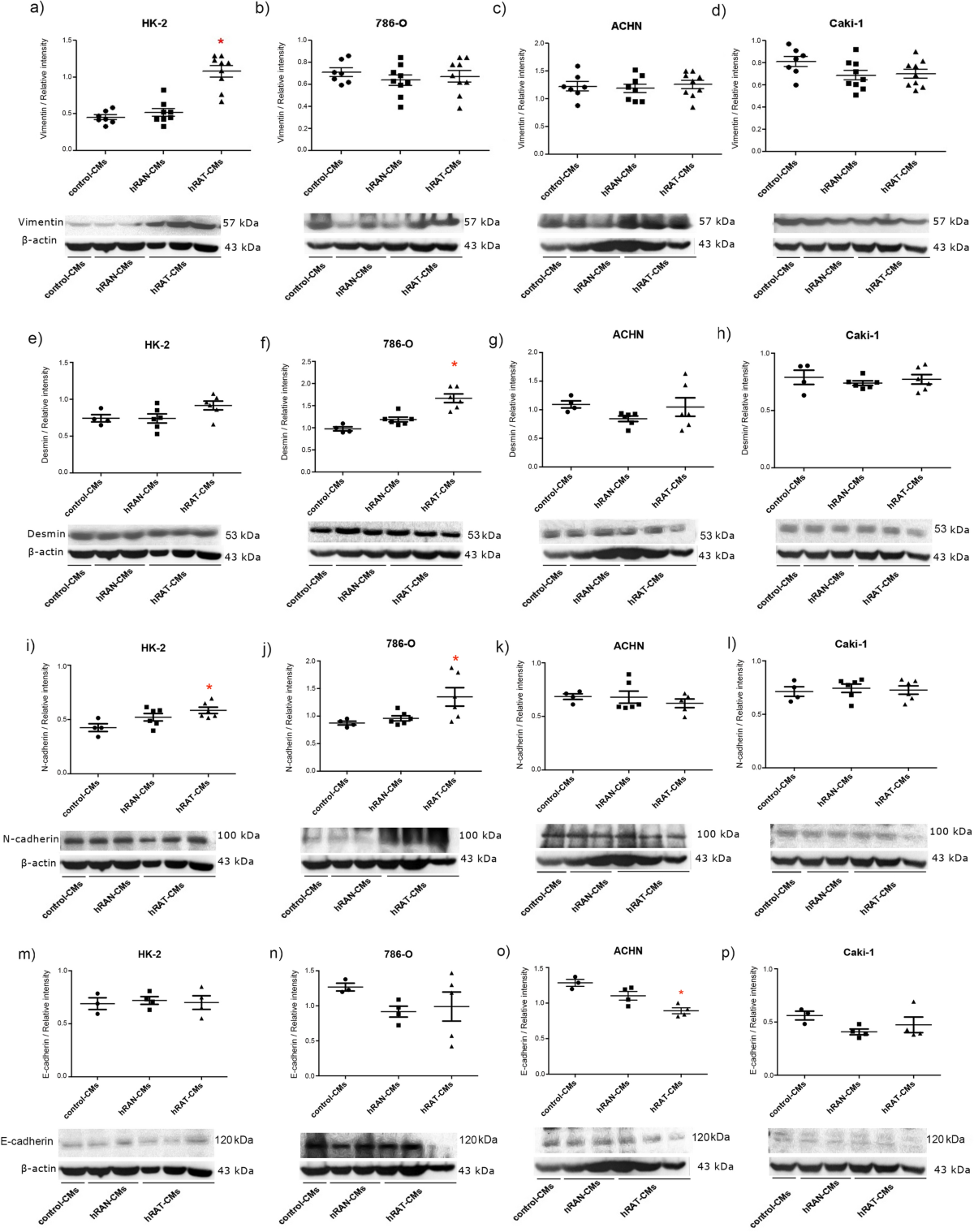 Renal Peritumoral Adipose Tissue Undergoes A Browning Process And Stimulates The Expression Of Epithelial mesenchymal Transition Markers In Human Renal Cells Scientific Reports Renal Peritumoral Adipose Tissue Undergoes A Browning Process And Stimulates The Expression Of Epithelial mesenchymal Transition Markers In Human Renal Cells Scientific Reports